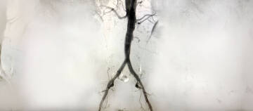 ANGIOLOGIA – DZIEDZINA POKREWNA CHIRURGII NACZYNIOWEJ